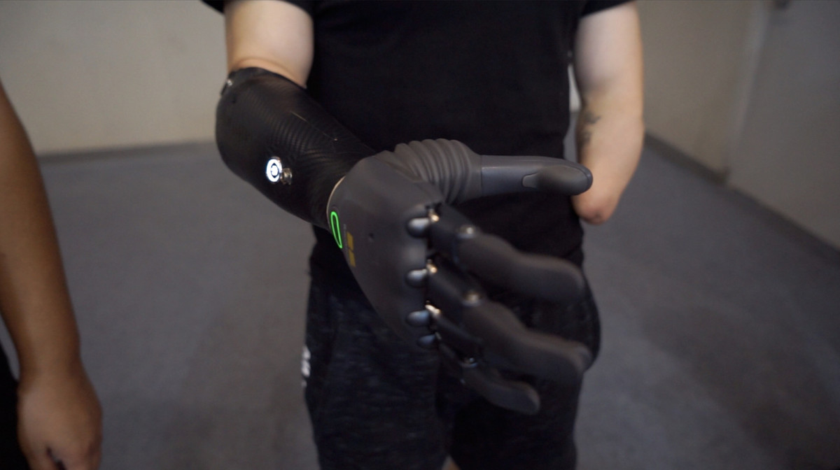 Smart-Life-artificial-hands