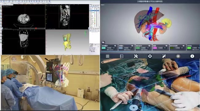 Holographic 3D Medical Imaging Technology(Photo provided to Chongqing Qinying Technology Co., Ltd)