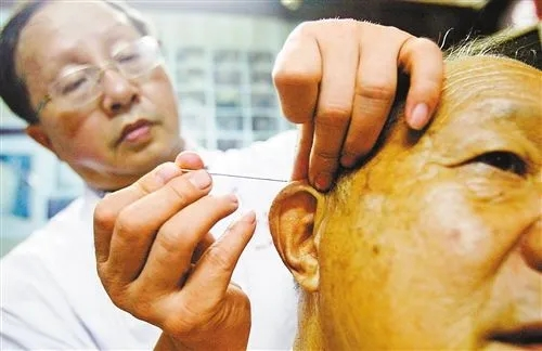 Audible | Chinese Medical Technique:Liu's Bloodletting and Fire-ironing Acupuncture Therapy