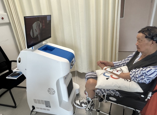 Revolutionizing Rehab: Brain-Computer Interface Transforms Recovery to Active