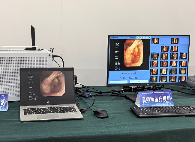 Diagnosis Accuracy Reaching 90%, Chongqing Unveils China's First AI Model for ENT Healthcare