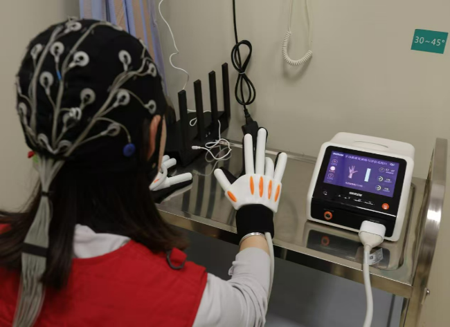 Chongqing Opens SW China's First Brain–Computer Interface Ward for Personalized Neurological Treatment