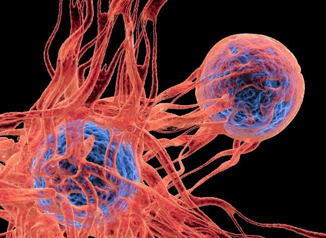 Team of Chinese, U.S. Scientists Identifies Key Tumor Cell State Driving Cancer Growth, Drug Resistance